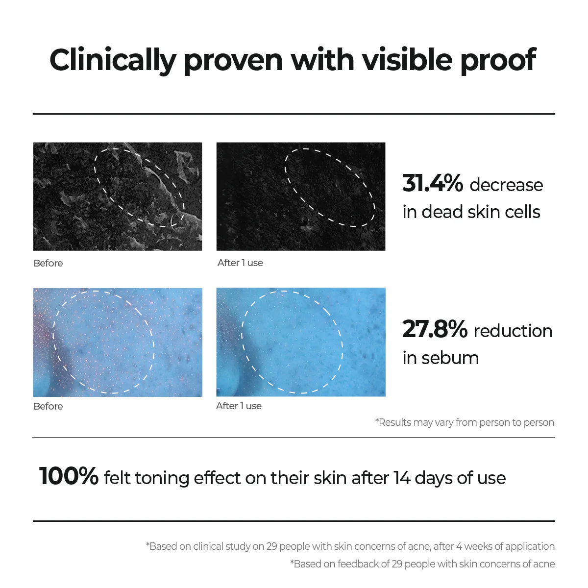 Aestura - Theracne365 Active Serum 30mL