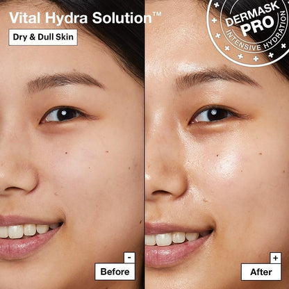 Dr.Jart+ - Vital Hydra Solution Face Mask x 5pcs