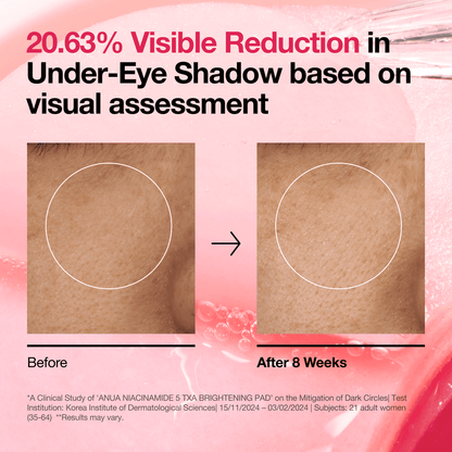 Anua - Niacinamide 5 TXA Brightening Pad 210ml 60ea