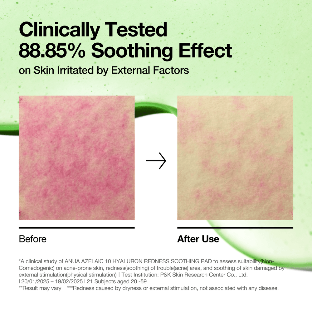 Anua - Azelaic 10 Hyaluron Redness Soothing Pad 230mL 90ea
