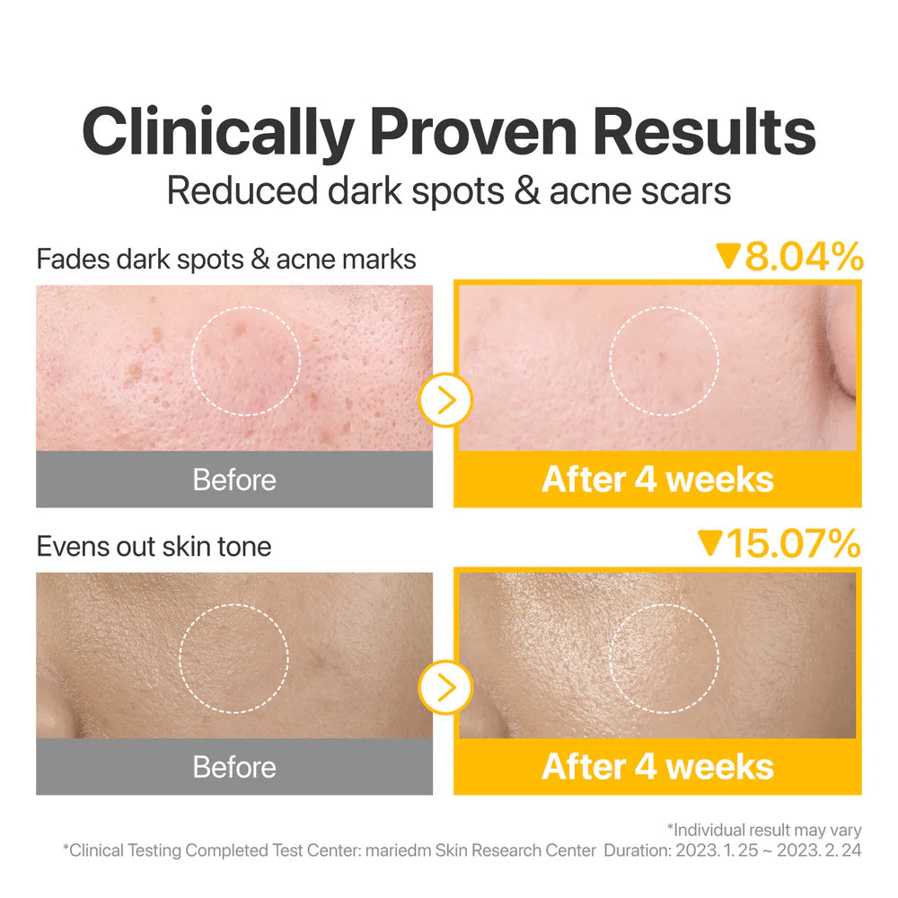 numbuzin - No.5 Vitamin-Niacinamide Concentrated Pad 70Pads 180mL