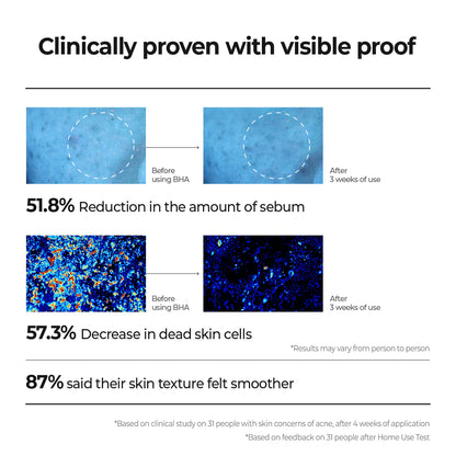 Aestura - Theracne Hydro Active Toner 200mL