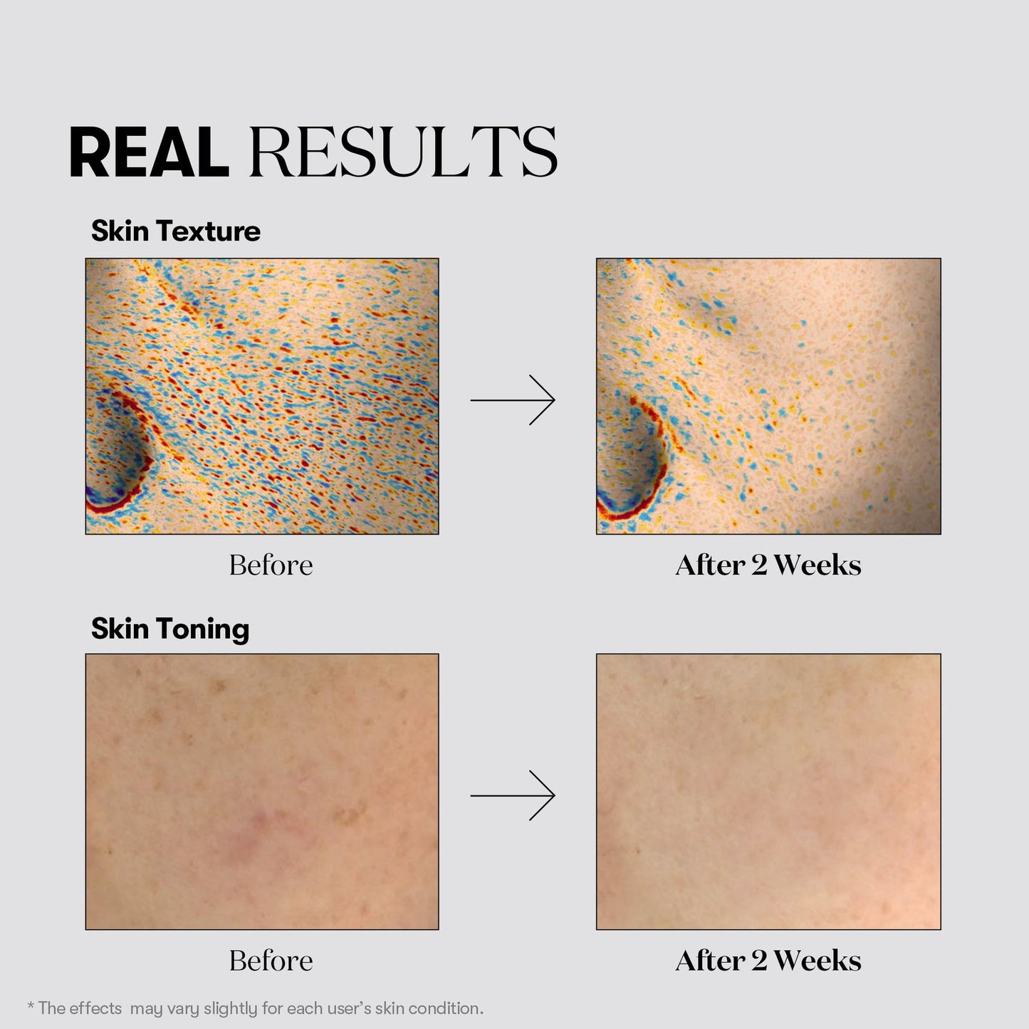 VT Cosmetics - TX-Toning Toner 200mL