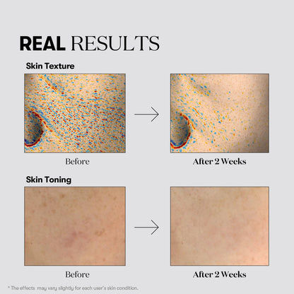 VT Cosmetics - TX-Toning Toner 200mL