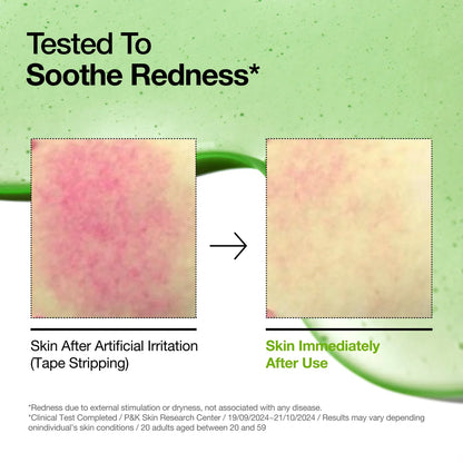 Anua - Azelaic Acid Hyaluron Soothing Serum 30ML