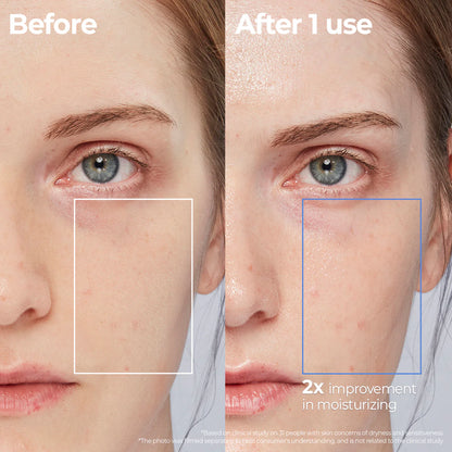 Aestura - Atobarrier 365 Lotion 150mL