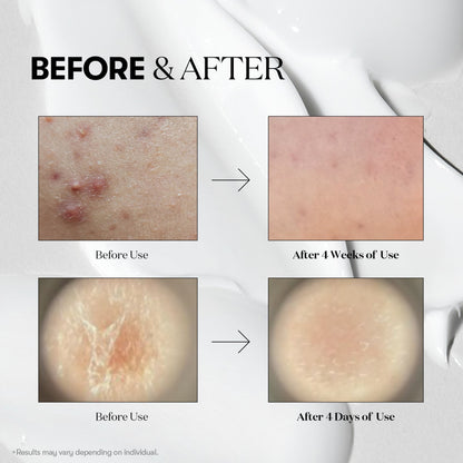 VT Cosmetics - 100 Reedle shot 10pcs