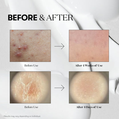 VT Cosmetics - Reedle Shot 50 50mL